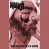 Hulla = Supermassive Black Wound - MC