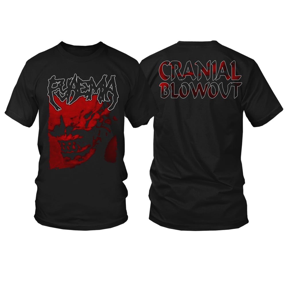 PYAEMIA - CRANIAL BLOWOUT (T-SHIRT & LONGSLEEVE)