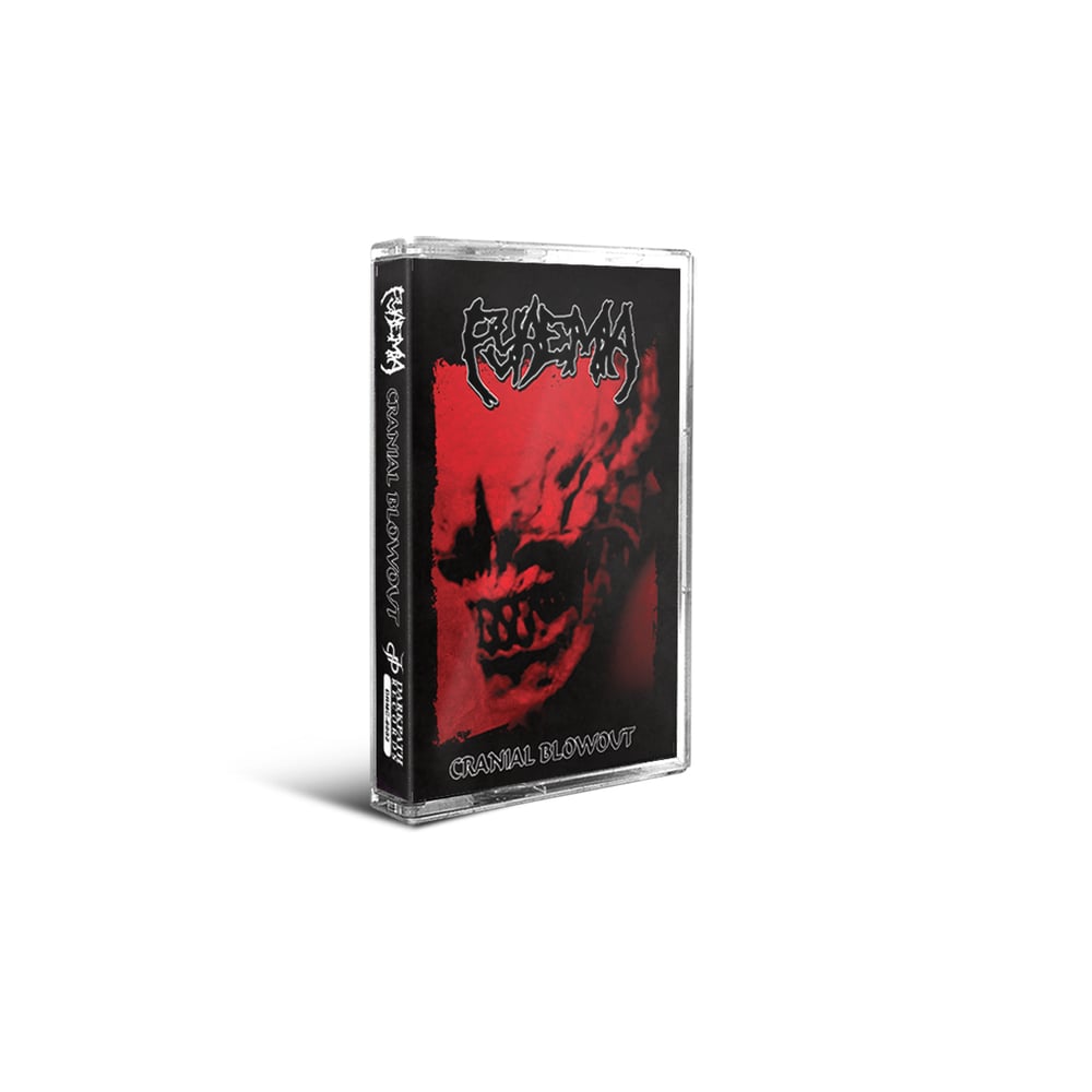 PYAEMIA - CRANIAL BLOWOUT (CASSETTE + CD)