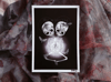 The Twins Print