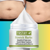 Stretch Mark Cream removes scars and marks