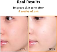 Image 2 of Isntree Hyper Vitamin C23 Serum 20 ml