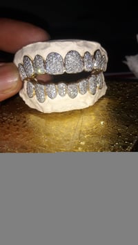 Image of Diamond grillz 