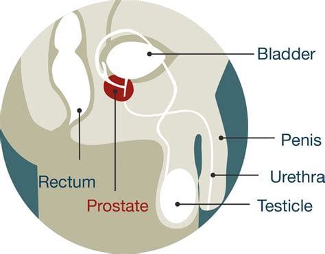 PROS-TATE! Prostate-Blood Pressure-Blood Sugar-Detoxer-Hair Loss-Eczema-Osteoarthrits
