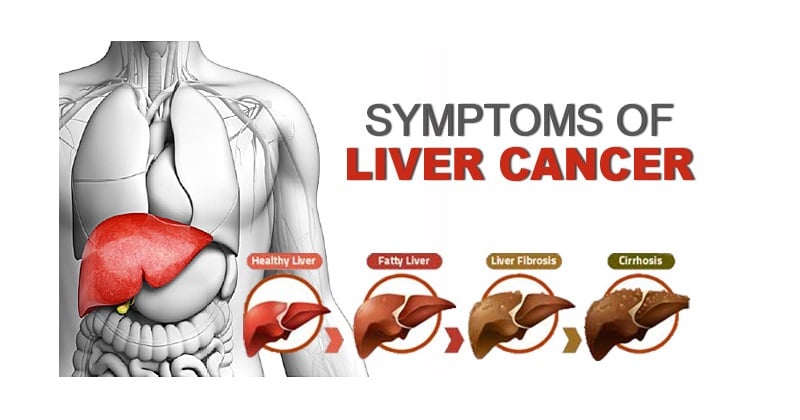 HEALthy LIVEr! Milk Thistle Seed Detoxer. Bones-Heart-Chemo-Diabetes-Cognition-Lactation-Hepatitis
