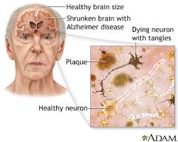 HEALthy LIVEr! Milk Thistle Seed Detoxer. Bones-Heart-Chemo-Diabetes-Cognition-Lactation-Hepatitis