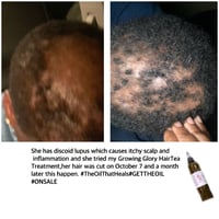 Image 2 of "Growing Glory" HairTEA Treatment 