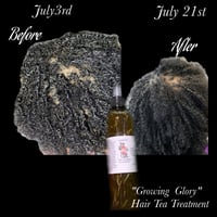 Image 5 of "Growing Glory" HairTEA Treatment(SALE‼️)