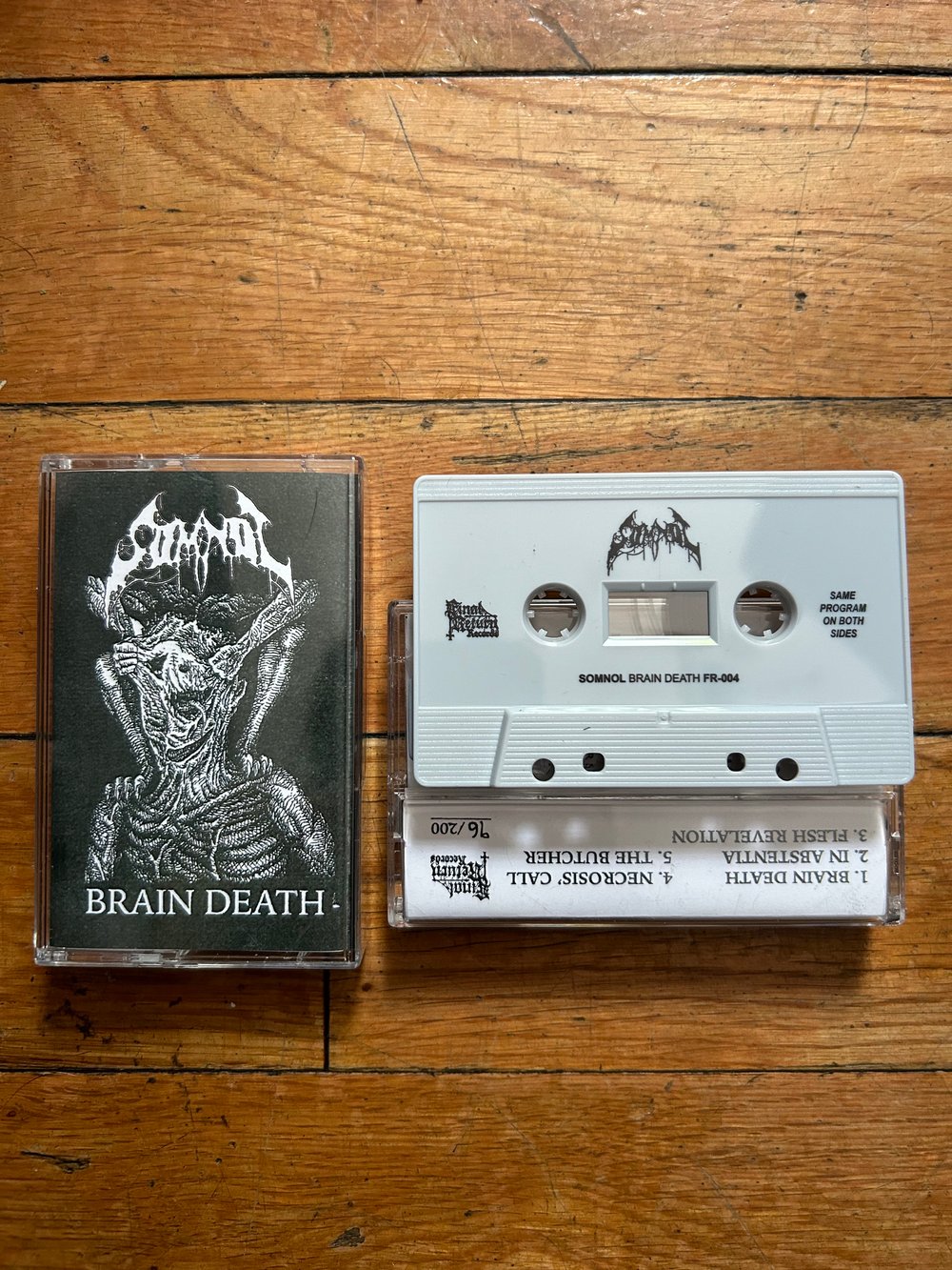 SOMNOL-BRAIN DEATH