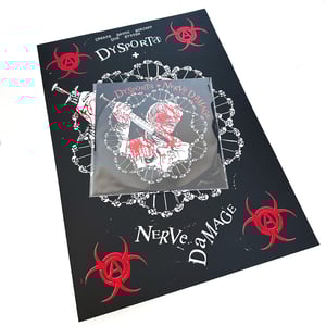 Dysporta + Nerve Damage 10"