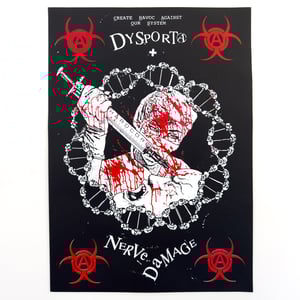 Dysporta + Nerve Damage 10"