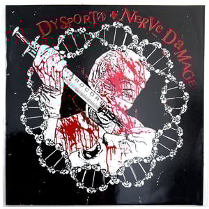 Dysporta + Nerve Damage 10"