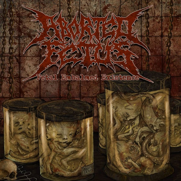 Image of ABORTED FETUS - Fetal Embalmed Existence CD