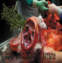 Drain of impurity-head disfigurement autopsy cd