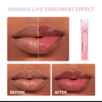 Image 2 of Lip Roller Oils 