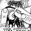 Sulfuric Cautery ''Cornea Lacerations'' - 7''EP