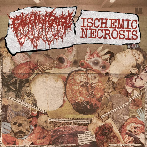 Image of ISCHEMIC NECROSIS / GOLEM OF GORE - Split CD