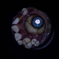 Image 4 of Teratoma Custom Swappable Phone Grip/Socket for smartphones