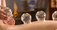 Image 1 of Fire Cupping Massge