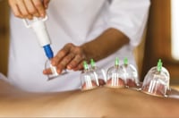 Image 1 of Dry Cupping Therapy
