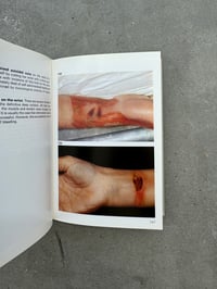 Image 2 of Color Atlas of Forensic Pathology - G. Austin Gresham