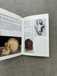 Image 3 of Color Atlas of Forensic Pathology - G. Austin Gresham