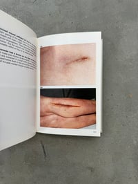Image 4 of Color Atlas of Forensic Pathology - G. Austin Gresham