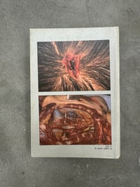 Image 5 of Color Atlas of Forensic Pathology - G. Austin Gresham