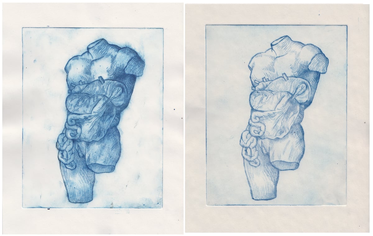 Image of Anatomical Intaglio Prints