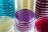 Pre Poured Agar Dishes 50 pack