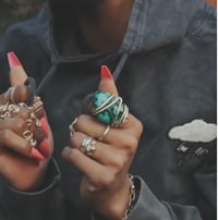 Malachite Ring
