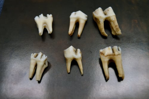 Image of Teeth Rings