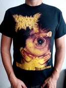 Image of VISCERA INFEST “Teratoma”