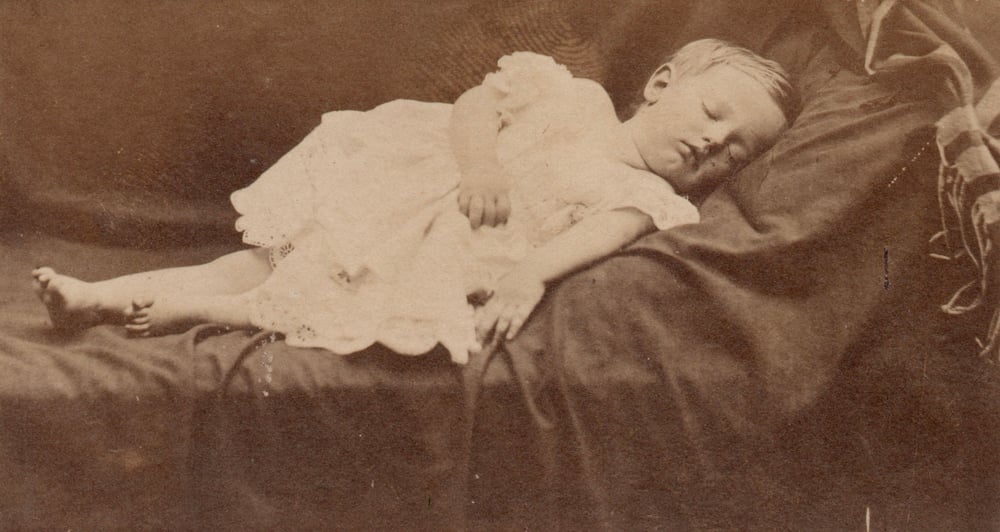 Image of Anonyme: sleeping child, Ireland ca. 1860