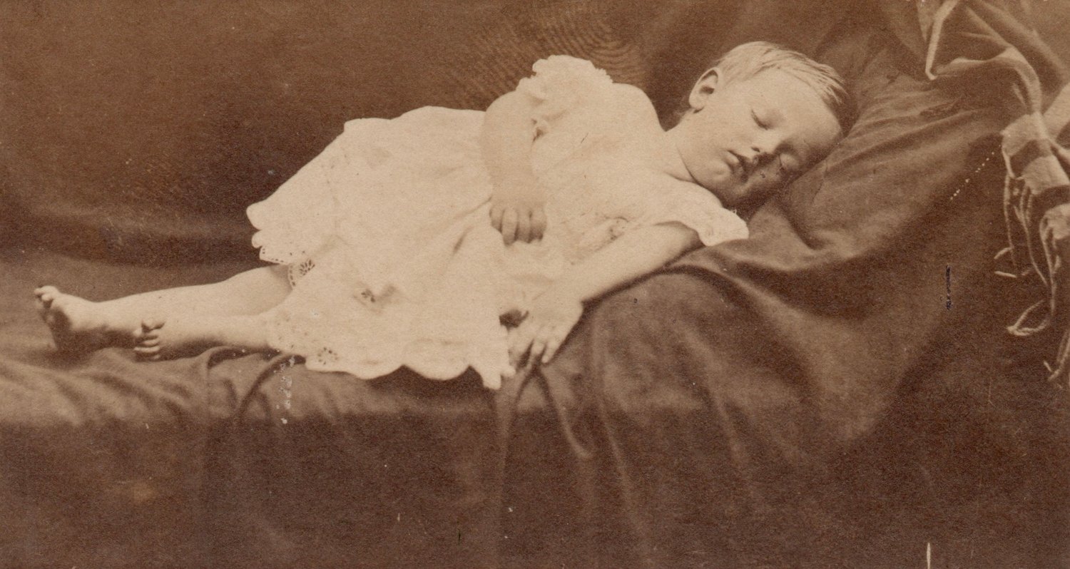 Image of Anonyme: sleeping child, Ireland ca. 1860