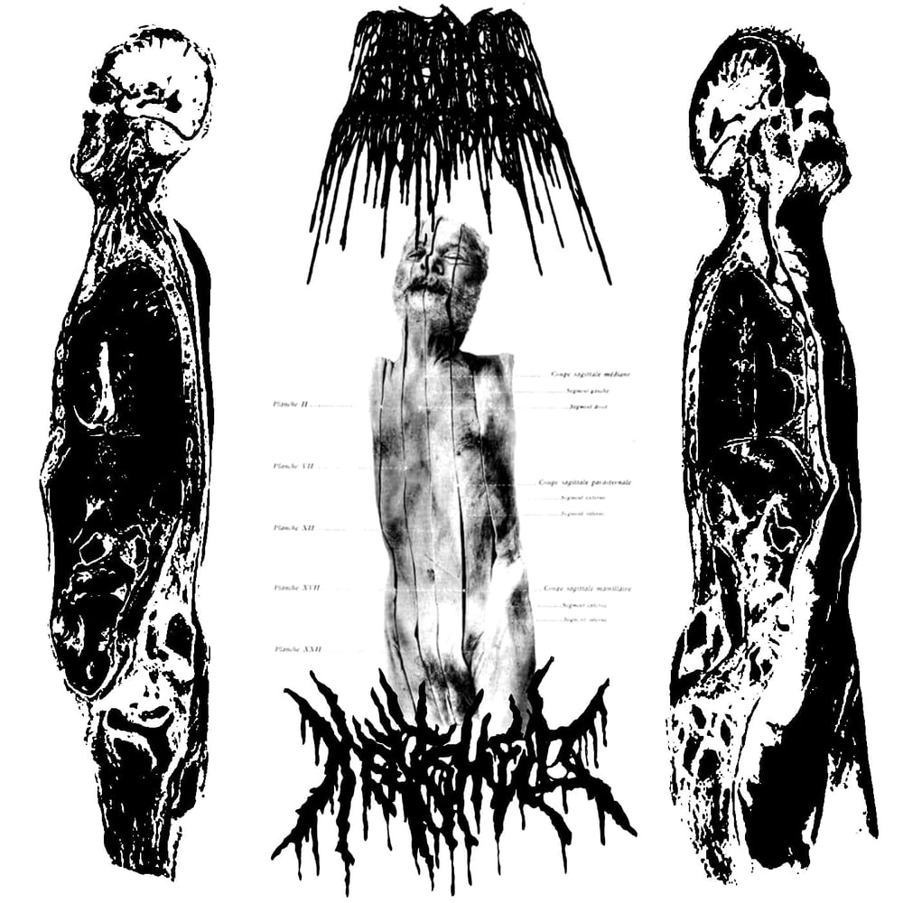 Meatshield / Aroma - Human Cross Section Collection Split CS