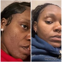 Image 4 of Kojie Skin Cleanser 