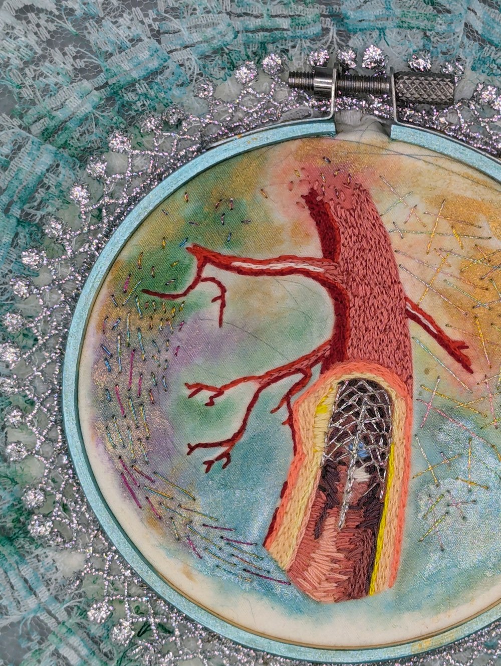 Arterial Stent - Embroidery 