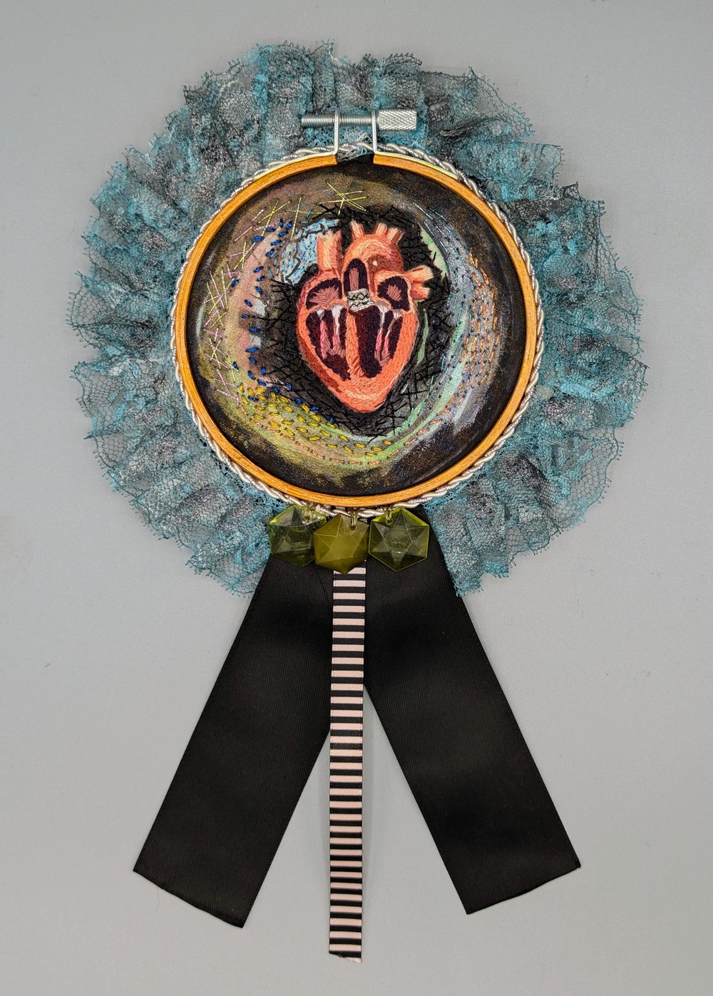 Heart Valve Stent - Embroidery Award Ribbon 