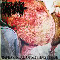 Image 1 of NEURAL INDENT "RAPID SPREAD OF ROTTING TISSUE" CD