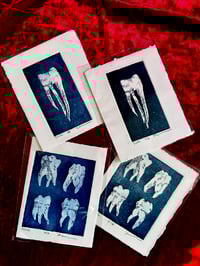 Image 1 of Intaglio Teeth Prints