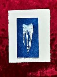 Image 4 of Intaglio Teeth Prints