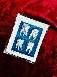 Image 2 of Intaglio Teeth Prints