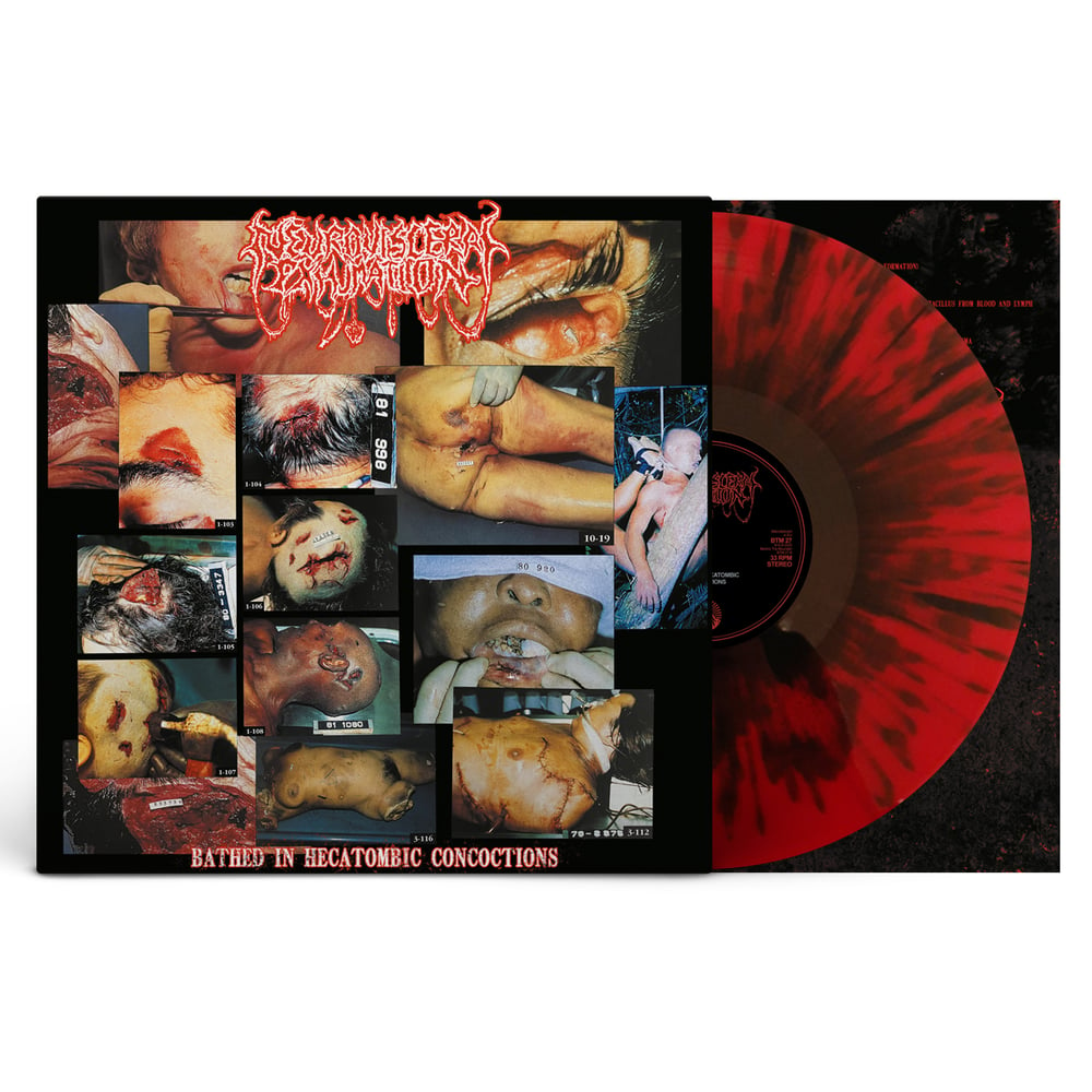 Lymphatic Phlegm / Neuro-Visceral Exhumation LP (SPLATTER)