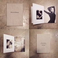 Skin & Bones - Book
