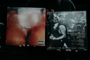 HARD PILL “SELF TITLED” 12” VINYL