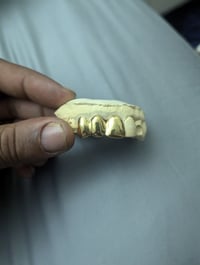 Image of 22k gold 