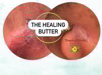 Image 2 of The Healing Butter