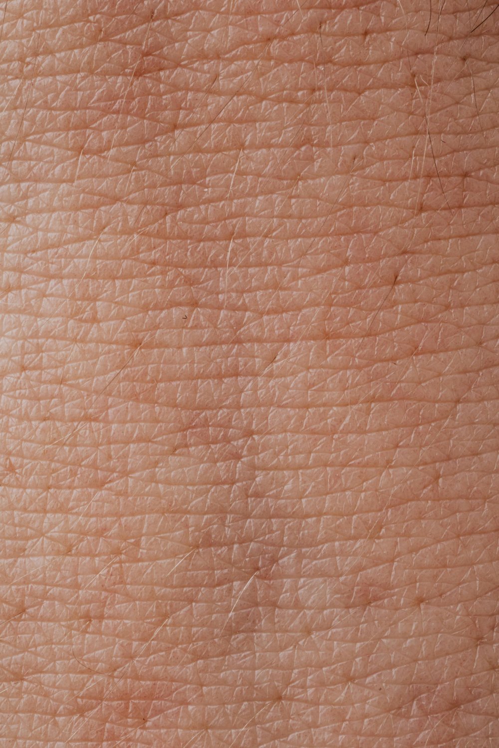 AVOskin-18! Anti-Aging Avocado Body Butter.  Luxurious. Exotic. Smooth. Silky/Acne. Eczema. SPF15. 