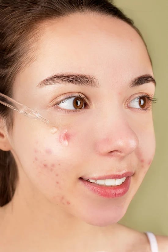 EXOCTIC SKIN OILS: Watermelon-Papaya-Raspberry-Apple-Camellia-Jojoba-Calendula-Avocado. SPF